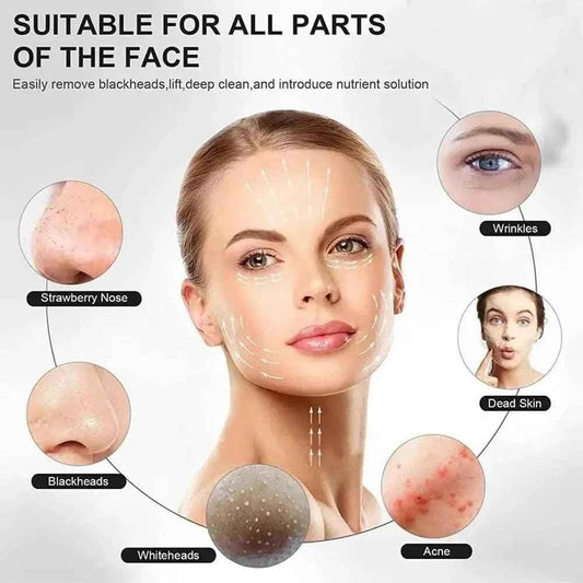 Ultrasonic Skin Scrubber, Deep Cleansing Facial Exfoliator, Vibrating Face Cleaner, Blackhead Extractor, Facial Massager with Ultrasonic Peeling, Cavita