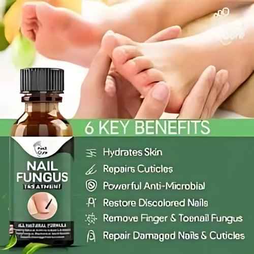 Nail Fungus Treatment Serum 10ml – Fast & Effective Fungal Solution