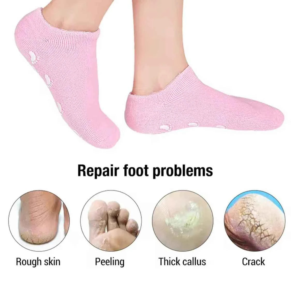 Reusable Moisturizing Gel Heel Socks.