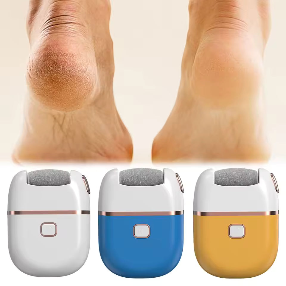 Electric foot grinder for calluses in white blue and yellow with before and after heel skin results